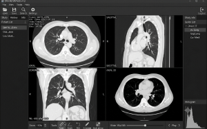 DICOM Image Viewer